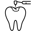 Pulp Capping Treatment